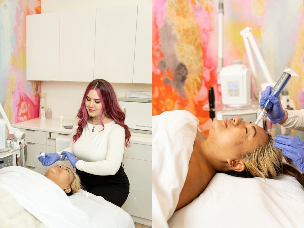Microneedling session at Virginia skin spa with calm, professional setting